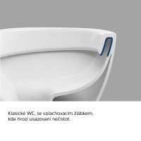 Mereo WC závěsné kapotované, RIMLESS, 490x370x360, keramické, vč. sedátka CSS113S