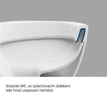 Mereo WC závěsné kapotované, RIMLESS, 520x370x355, keramické, vč. sedátka